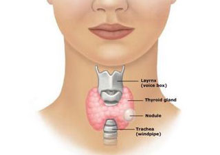 Thyroid Nodules/Cyst